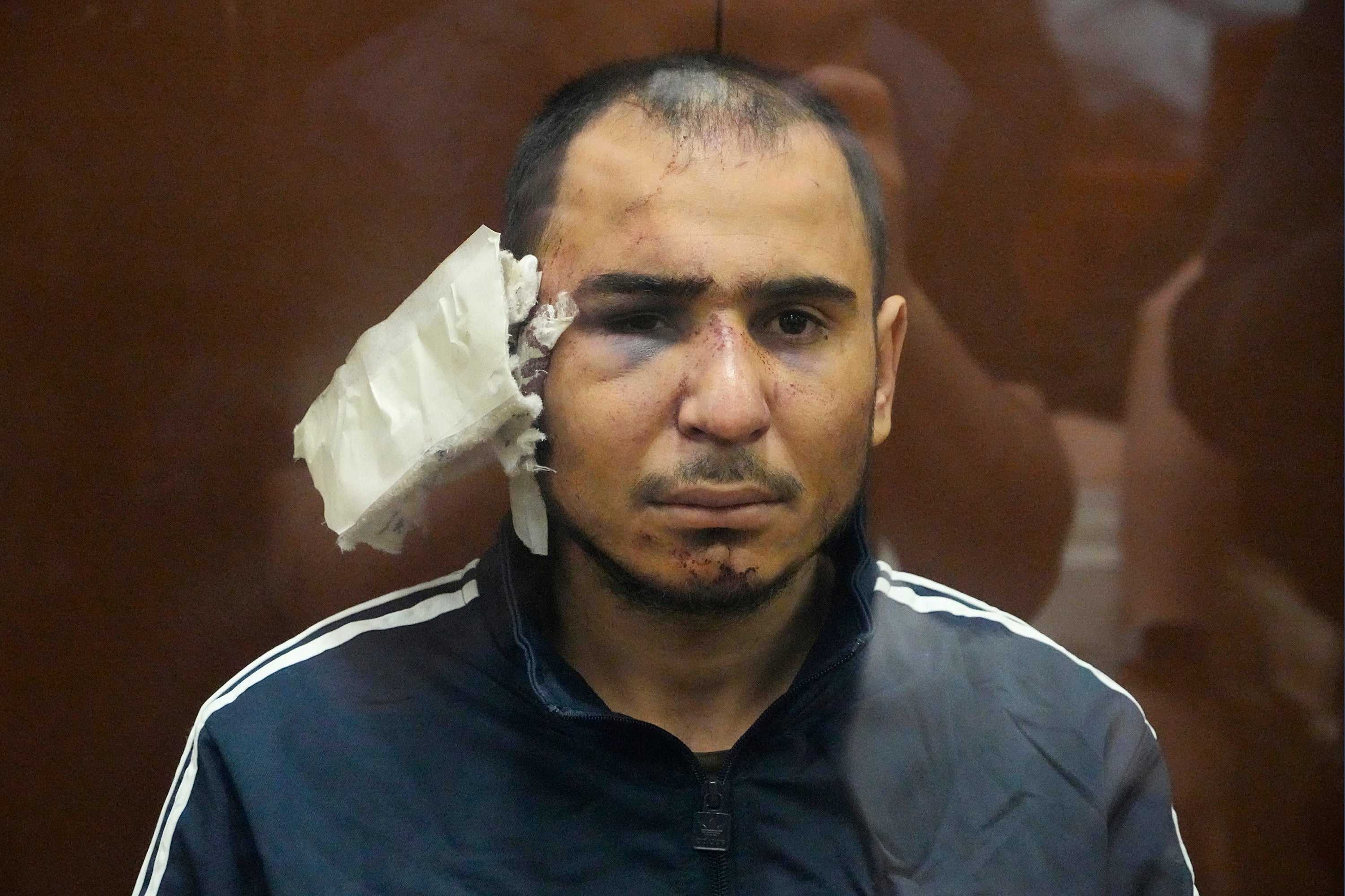 

<p>Saidakrami Murodali Rachabalizoda, a suspect in the Crocus City Hall shooting on Friday, sits in a glass cage in Moscow with a heavily bandaged right ear</p>
<p>” height=”2000″ width=”3000″ layout=”responsive” i-amphtml-layout=”responsive”><i-amphtml-sizer slot=