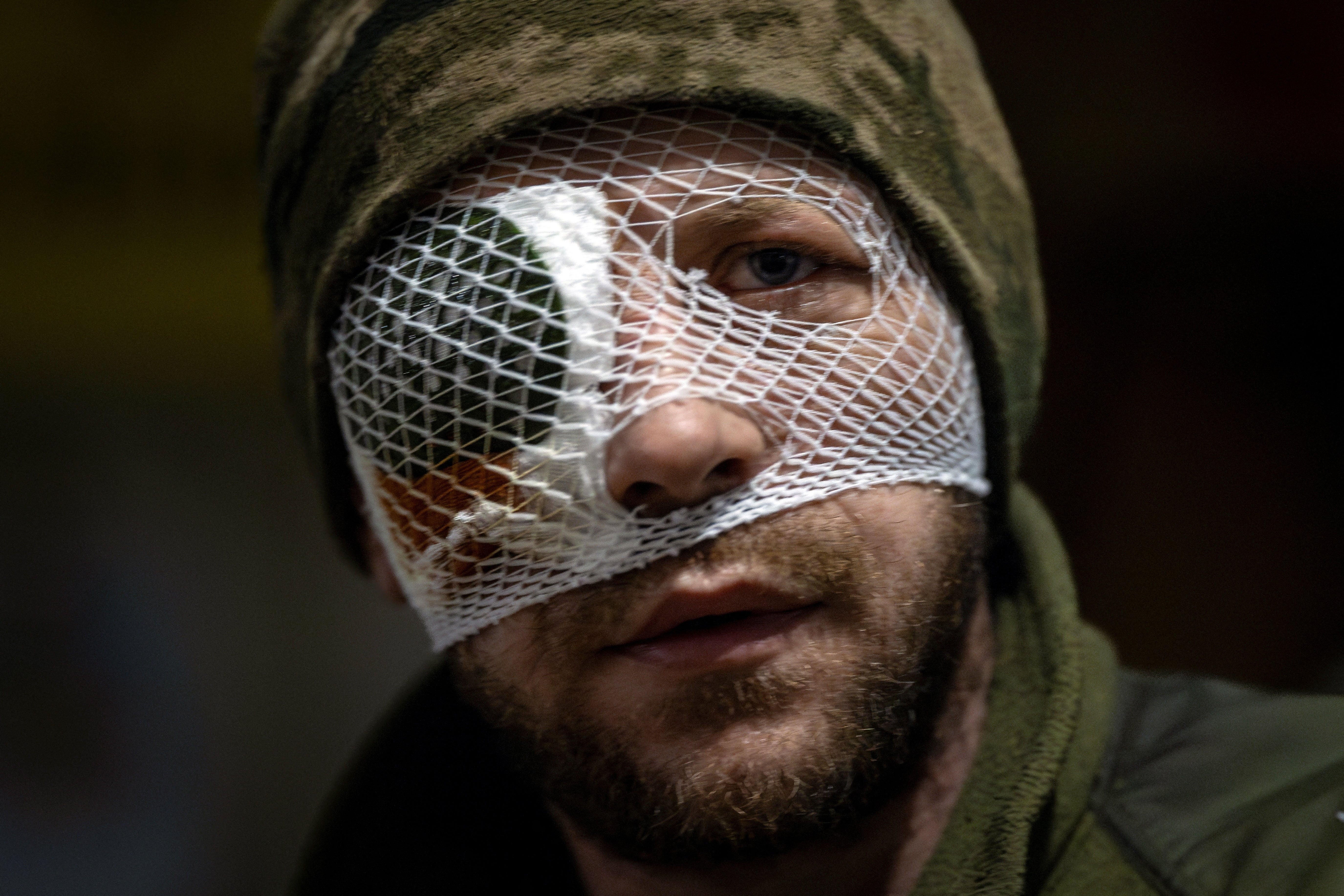 An injured soldier looks on in a medical stabilisation point near the frontlines in the Donetsk region