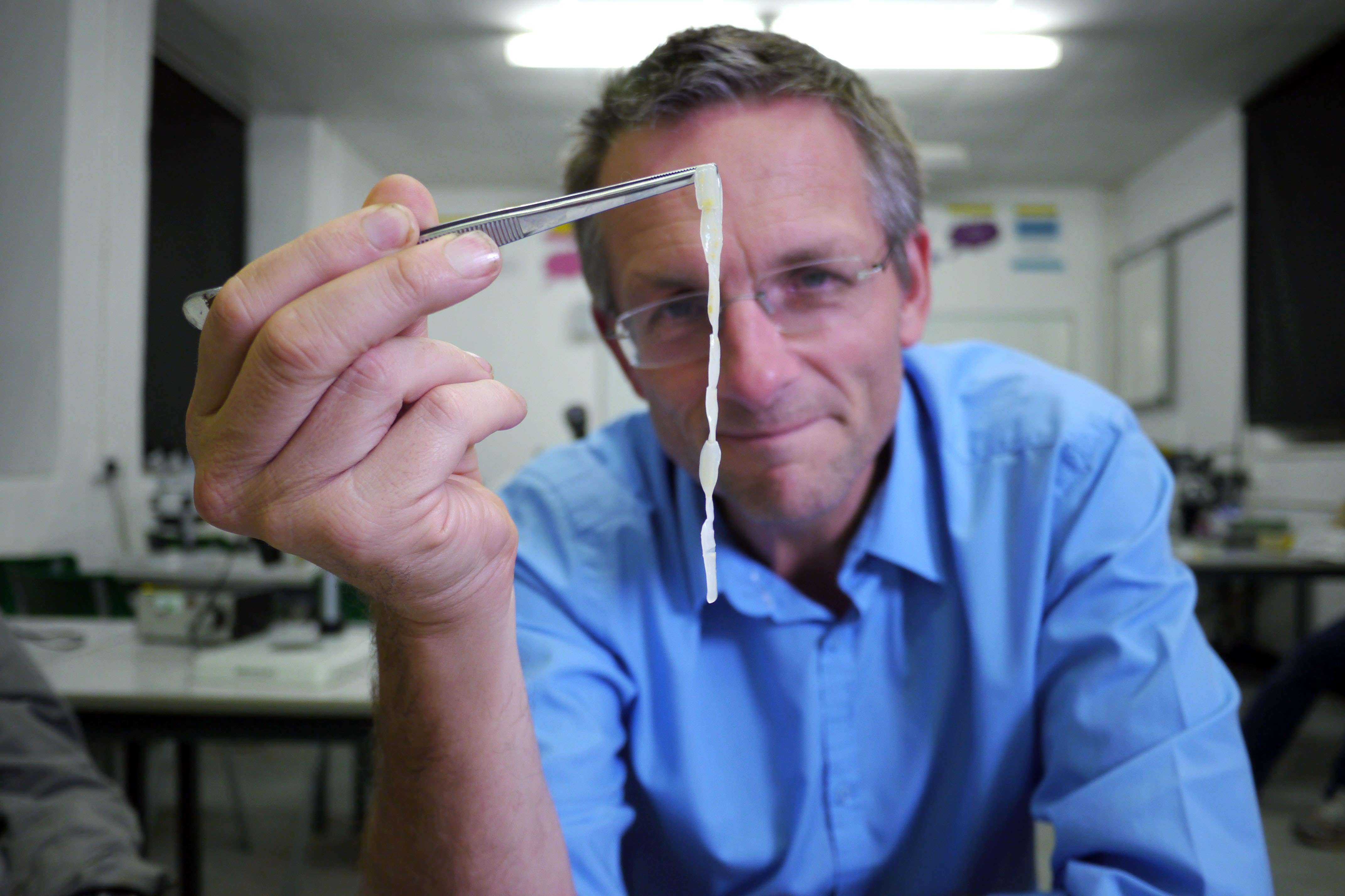 Michael Mosley infected himself with tapeworms (Nathan Williams/BBC)