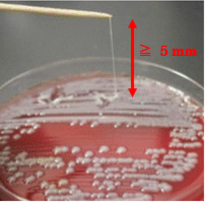 Hypermucoviscous ‘stickier than usual’ strains of K pneumoniae